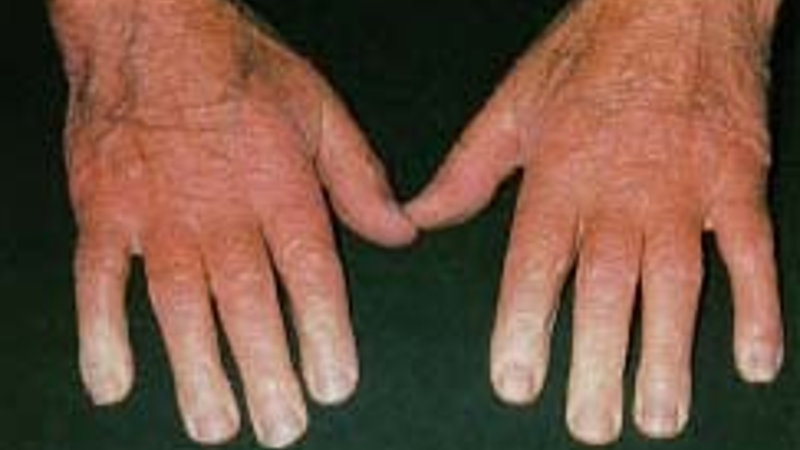 243 X 157 white fingers 243 X 157 white fingers